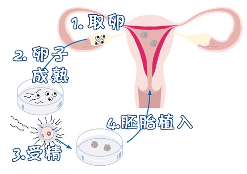 生殖科主任